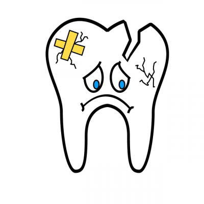 broken tooth 2351797_640 2 1