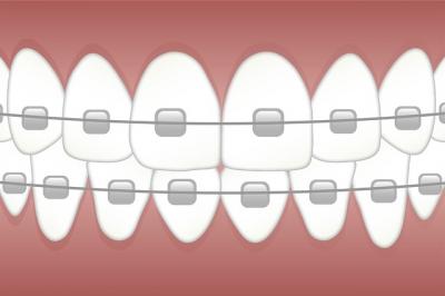 orthodontiste creil
